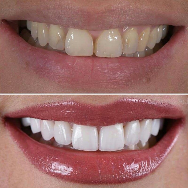 Bright Smile Dental